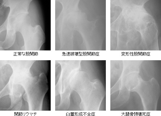 病院 股関節 専門